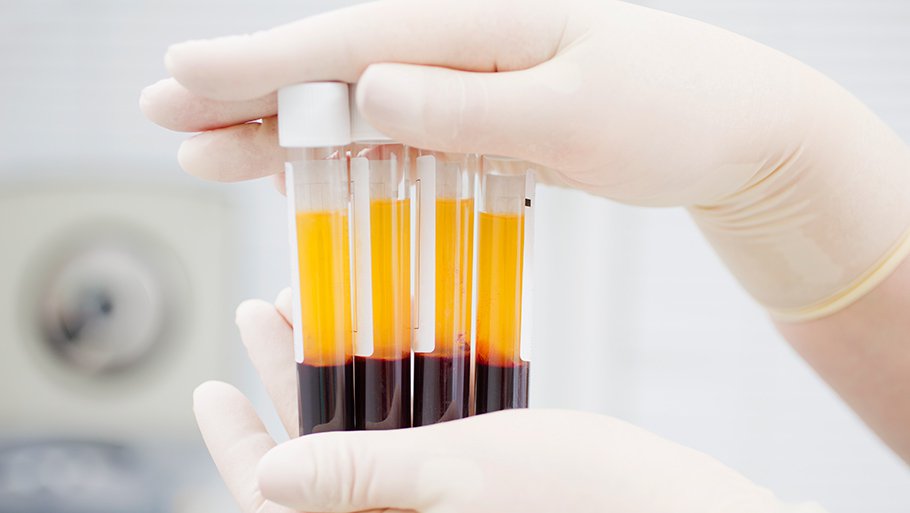 АЧТВ в анализе крови: причины отклонений и норма
